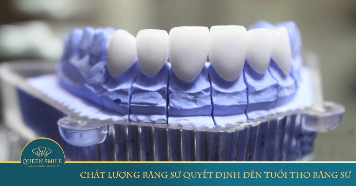 bọc răng sứ ở đâu tốt nhất tại hà nội và chất liệu răng sứ