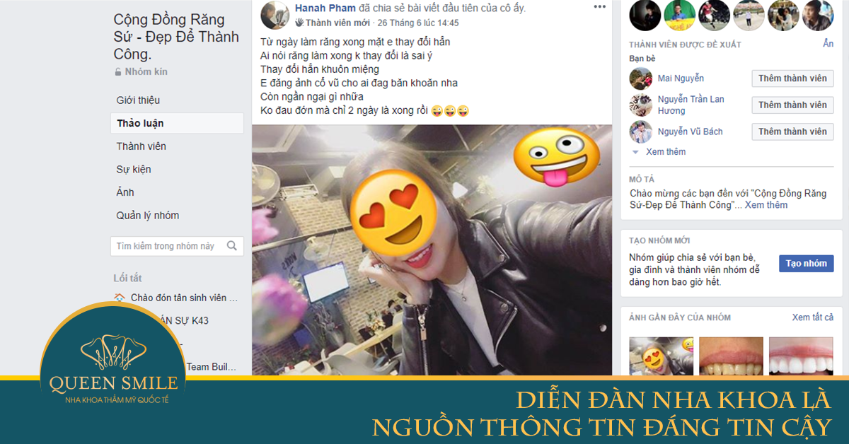 diễn đàn nha khoa bọc răng sứ ở đâu tốt nhất hà nội