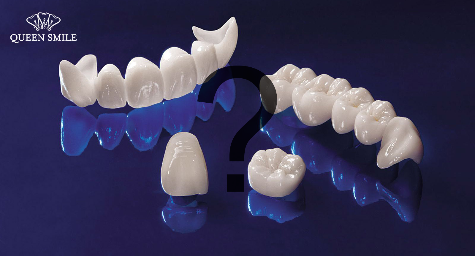 Bọc răng sứ thẩm mỹ - Lợi hay hại?