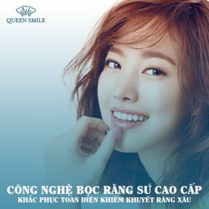 bọc răng sứ