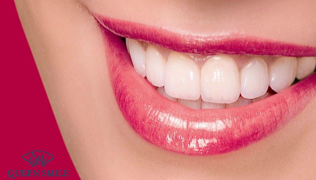 Hiện nay, các phương pháp bọc răng sứ cũng được chia theo tùy tình trạng răng miệng của từng người. kinh nghiệm bọc răng sứ thẩm mỹ từ chuyên gia