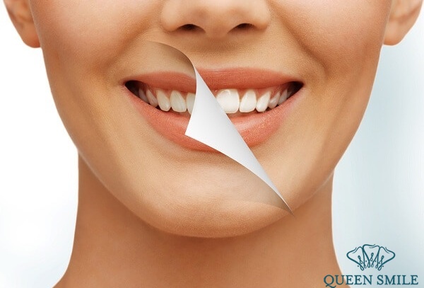 WhiteMax sử dụng bước sóng laser không sinh nhiệt, không gây kích ứng nên trong khi tẩy hoàn toàn không đau, không ê buốt và không bị bỏng rát tay-trang-rang-cong-nghe-moi-nhat-khong-gay-e-buot