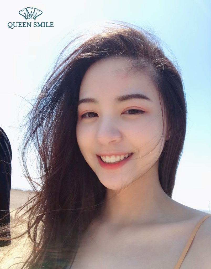 niềng răng tự tin