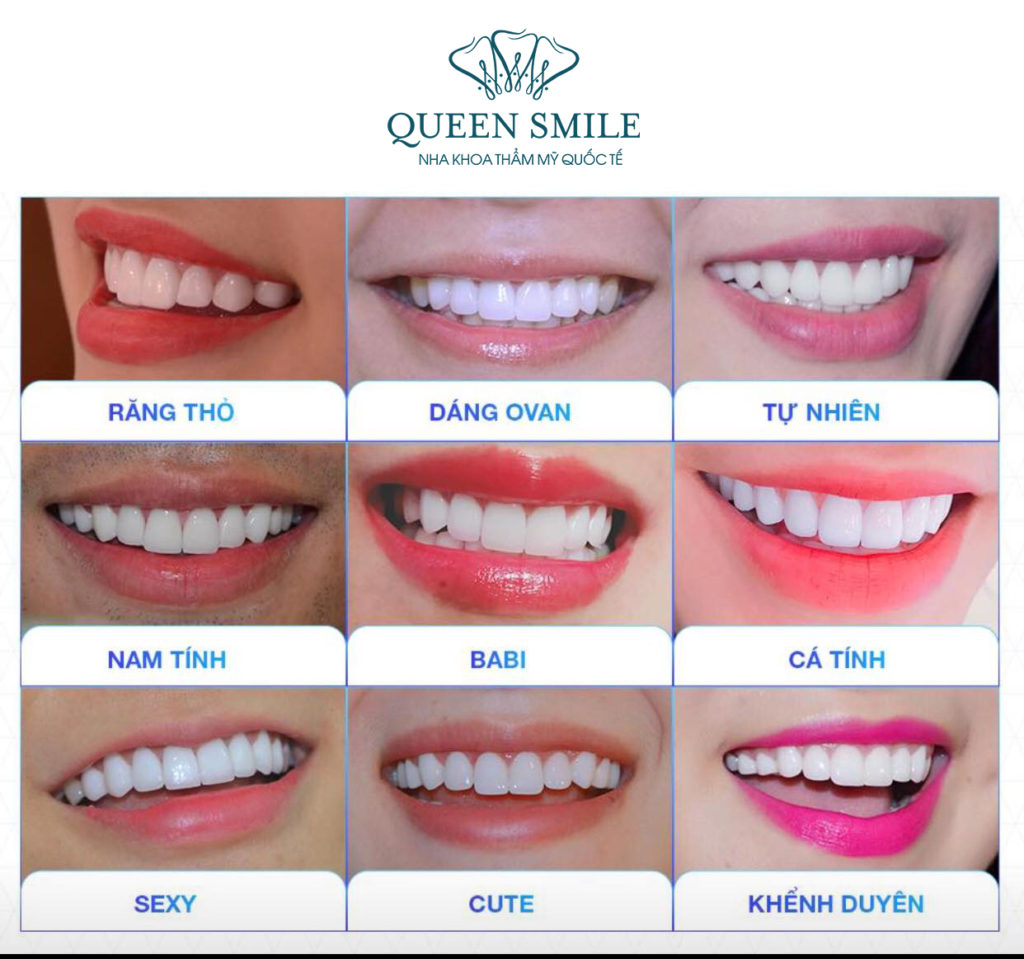 Các dáng răng sứ tại Queen Smile