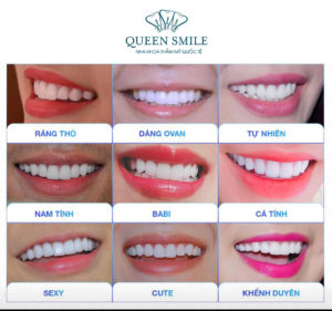 Các dáng răng sứ tại Queen Smile