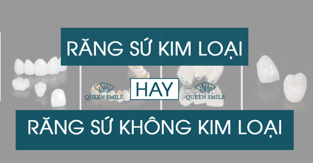bọc răng sứ kim loại hay không kim loại