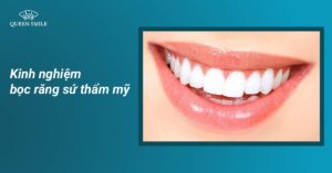 kinh nghiem boc rang su tham my