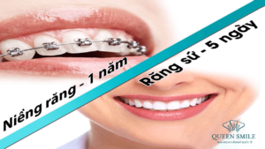 nieng rang hay boc rang su tham my