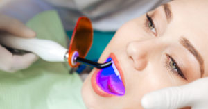 Dịch vụ tẩy trắng răng