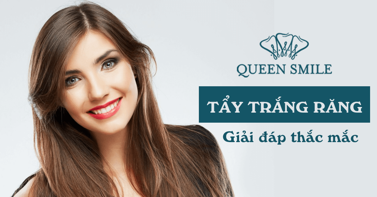 giải đáp thắc mắc công nghệ tẩy trắng răng mới nhất