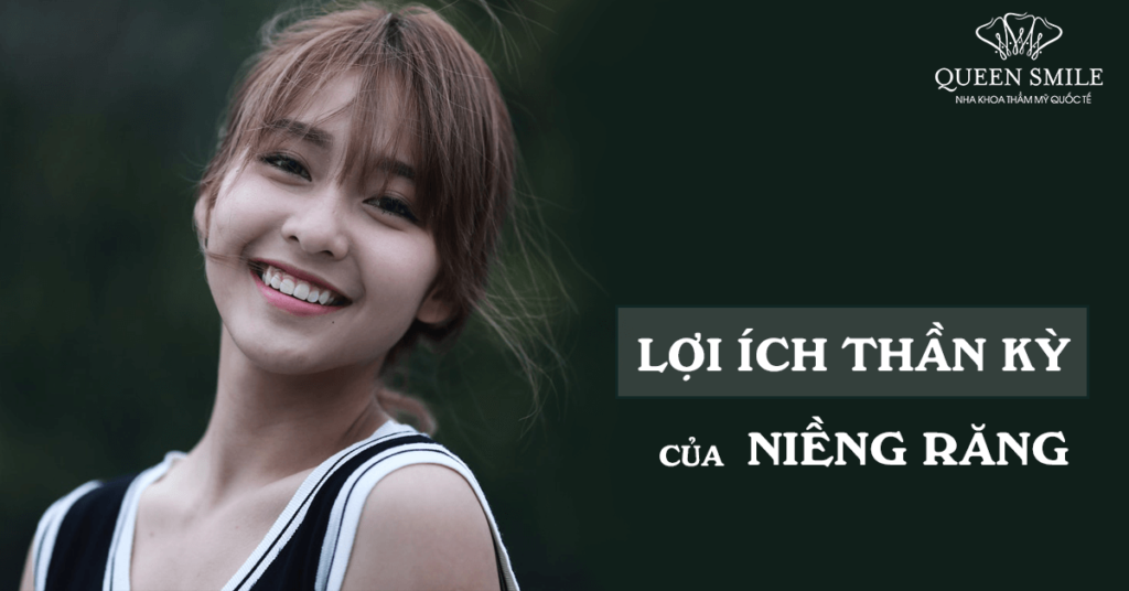 niềng răng có tác dụng gì