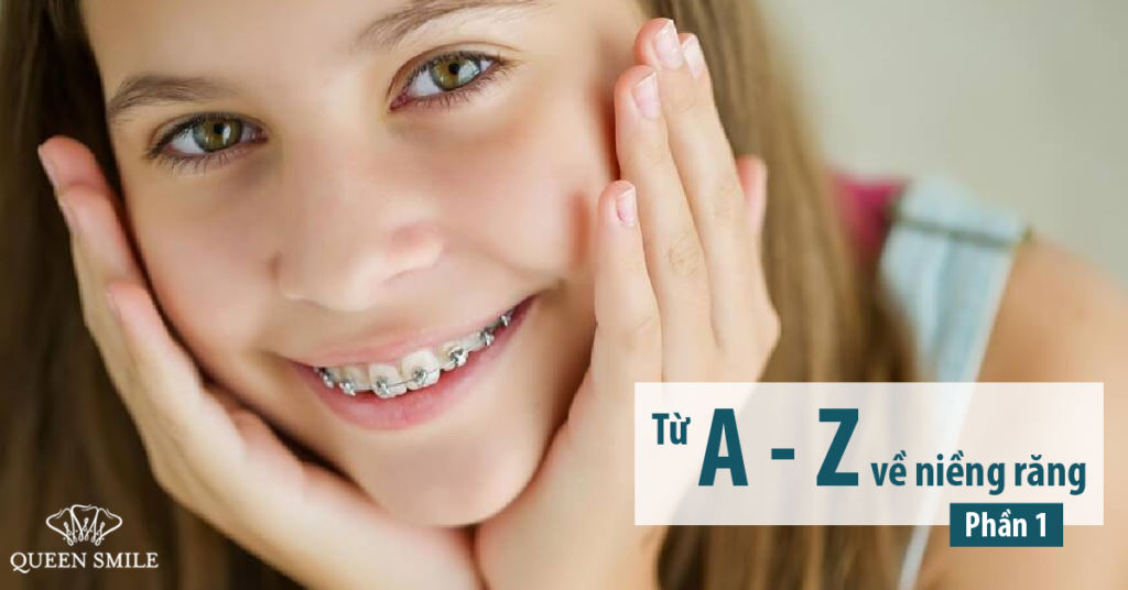 niềng răng mất bao lâu thì xong