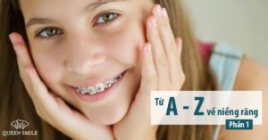 niềng răng mất bao lâu thì xong