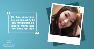 bọc răng sứ đẹp