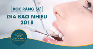 bọc răng sứ giá