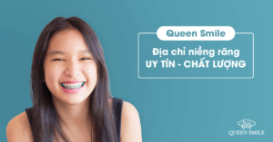 niềng răng ở đâu