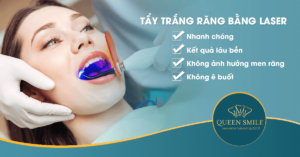 tẩy trắng răng tại nha khoa
