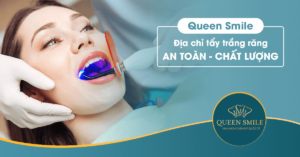 tẩy trắng răng ở đâu tốt