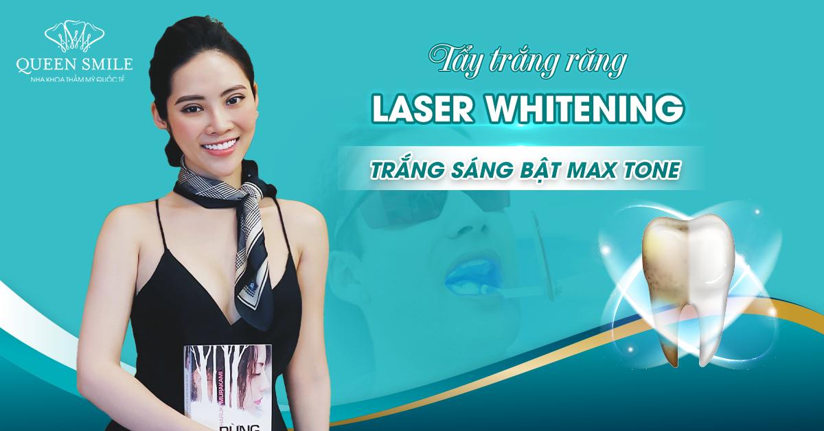 Tẩy trắng răng Laser Whitening - Răng sáng bật max tone