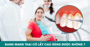 Đang mang thai có lấy cao răng được không?