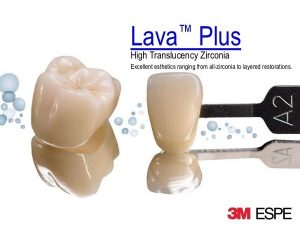 Răng sứ Lava Plus 3M có độ trắng sáng như răng thật