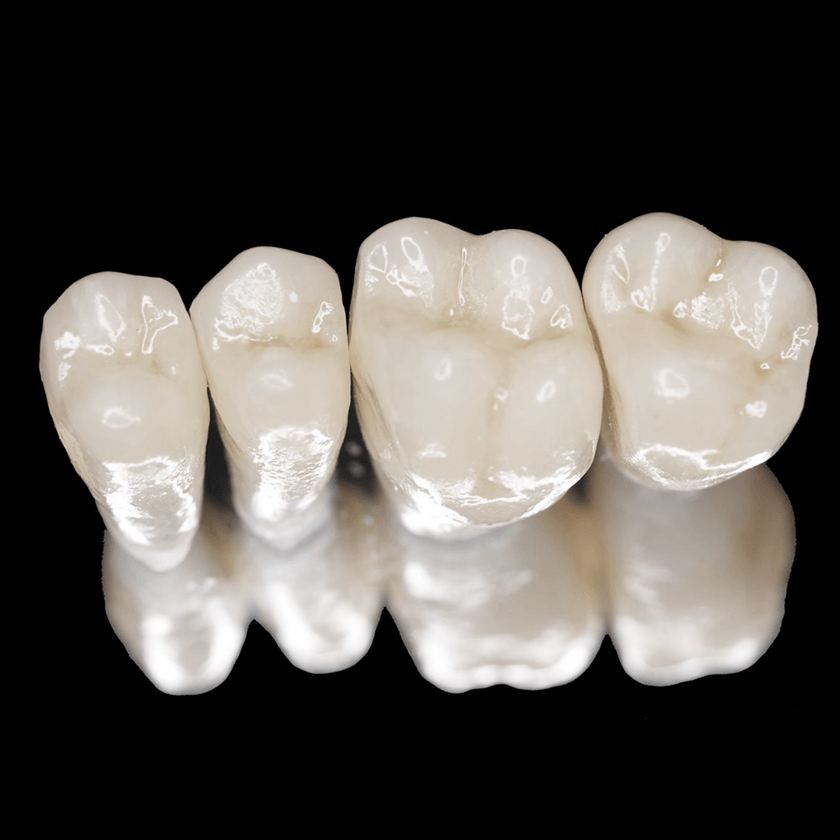 Chất liệu sẽ ảnh hưởng trực tiếp đến độ bền của răng sứ