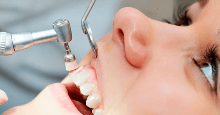 Bọc răng sứ không gây nguy hại cho sức khỏe răng miệng