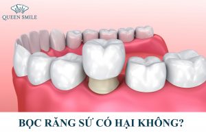 boc-rang-su-co-hai-khong