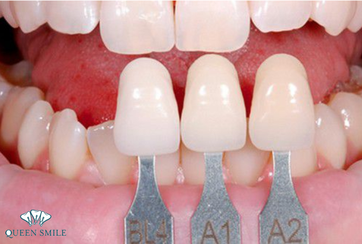 lam-rang-su-co-hai-khong