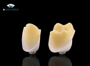 nen-boc-rang-su-loai-nao