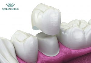 nen-boc-rang-su-o-dau