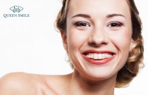 nieng-rang-su-gia-bao-nhieu