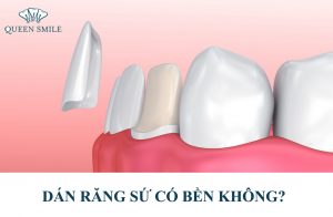 rang-su-co-ben-khong