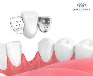 trong-rang-su-canh-dan