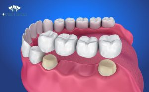 trong-rang-su-nguyen-ham