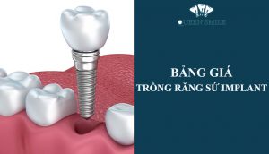 bang-gia-trong-rang-su