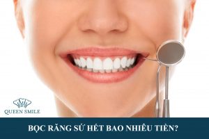 boc-rang-su-het-bao-nhieu-tien