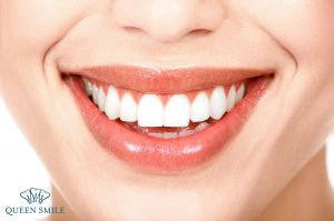 co-nen-boc-rang-su-cho-rang-khap-khenh