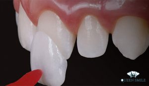 lam-rang-su-o-dau-tot