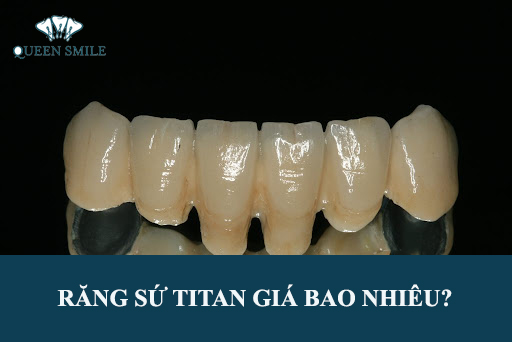 bang-gia-rang-su-titan