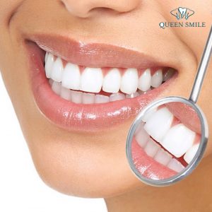 boc-rang-su-mat-bao-lau