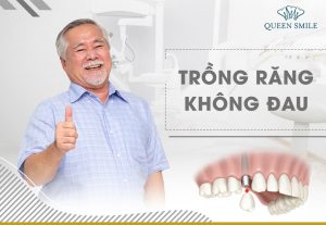 trong-rang-implant-co-dau-khong