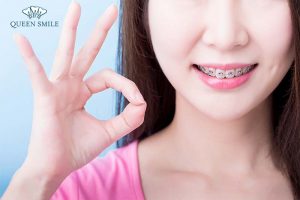 trong-rang-su-co-nieng-duoc-khong