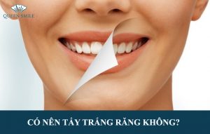 co-nen-tay-trang-rang-khong