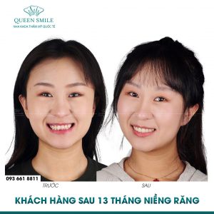 nieng-rang-bao-lau-thi-thao-duoc