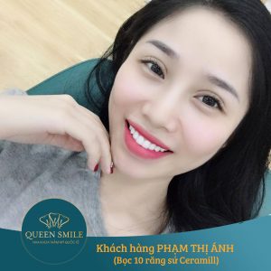 boc-rang-su-dung-duoc-bao-lau