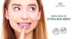 trong-rang-su--co-nieng-duoc-khong