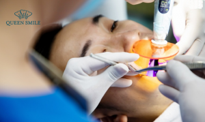 nho-rang-khon-moc-lech-3