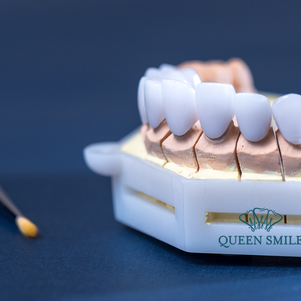 rang-su-tot-nhat-hien-nay