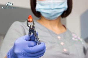 nho-rang-khon-co-an-toan-khong